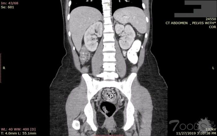 超10亿张患者医学图像被泄漏 但始终没引起医疗机构重视